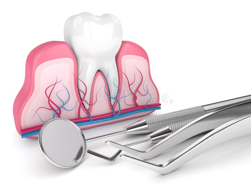 3d render of tooth in gums and dental diagnostic instruments over white background. 3d render of tooth in gums and dental diagnostic instruments over white background