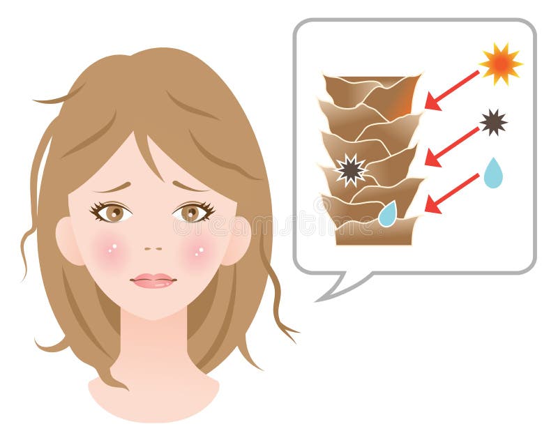 Damaged Cuticle Layer Cause Damaged Hair Stock Vector - Illustration of pollution, dust: 68333967 Damaged Cuticle Layer Cause Damaged Hair Stock Vector - Illustration of pollution, dust: 68333967