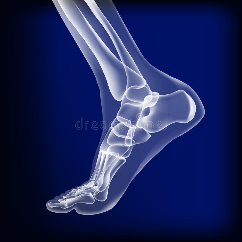 X Ray of Bones the of Foot. Medial View Stock Vector Illustration of