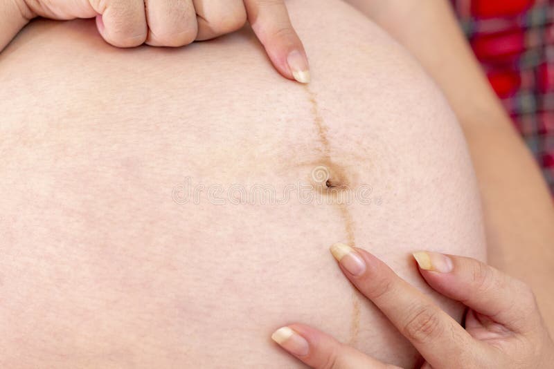 Dark Line on Your Pregnant Belly is the Linea Nigra Stock Image - Image of prenatal, beauty: 121211199 Dark Line on Your Pregnant Belly is the Linea Nigra Stock Image - Image of prenatal, beauty: 121211199