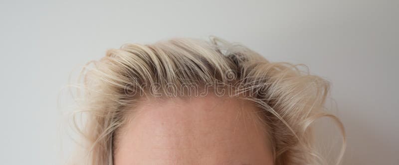 Dark Roots of Hair, Overgrown. Hair Roots, Color, Grey Hair, Hair Loss or Dry Scalp Problem Stock Image - Image of dyed, frustration: 187743725 Dark Roots of Hair, Overgrown. Hair Roots, Color, Grey Hair, Hair Loss or Dry Scalp Problem Stock Image - Image of dyed, frustration: 187743725