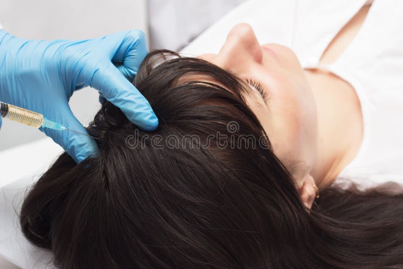 De arts introduceert plasma-opheffende injectie aan de patiënt om de kwaliteit en de schoonheid van het haar te verbeteren, close royalty-vrije stock foto's De arts introduceert plasma-opheffende injectie aan de patiënt om de kwaliteit en de schoonheid van het haar te verbeteren, close royalty-vrije stock foto's