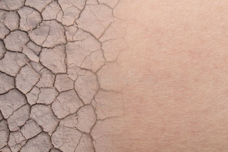 de droge textuur van de vrouwenhuid met droge grond