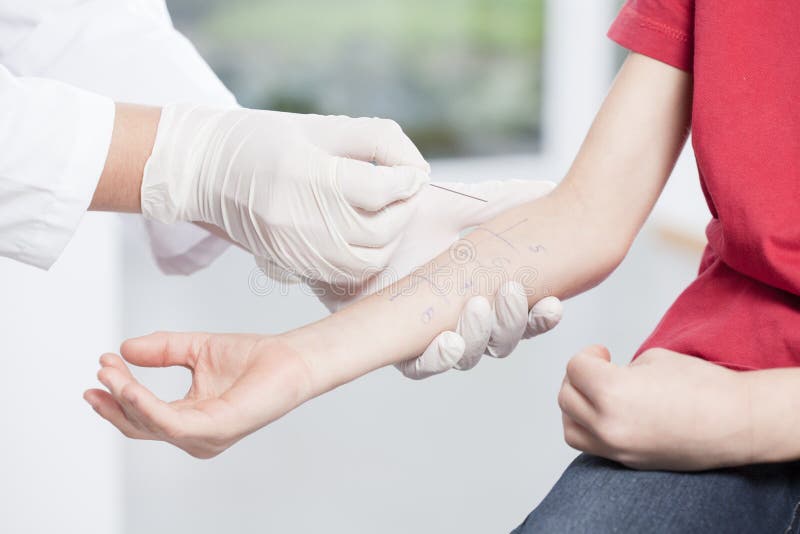 De handen die van de arts allergietest doen