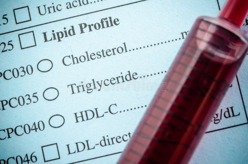 De medische Cholesterol, het triglyceride en het bloed van de controlelijst in synrin stock afbeelding De medische Cholesterol, het triglyceride en het bloed van de controlelijst in synrin stock afbeelding