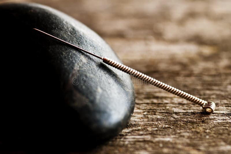De naald van de acupunctuur