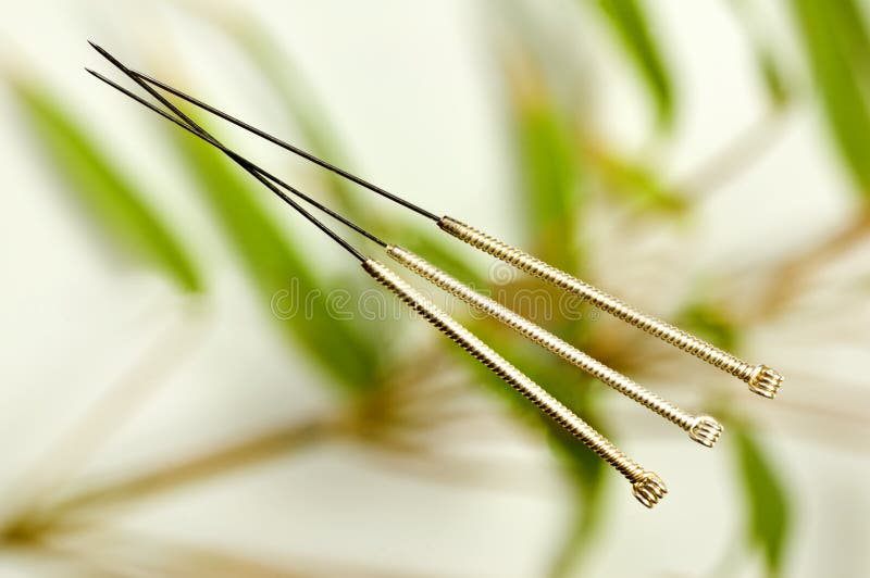 De naald van de acupunctuur