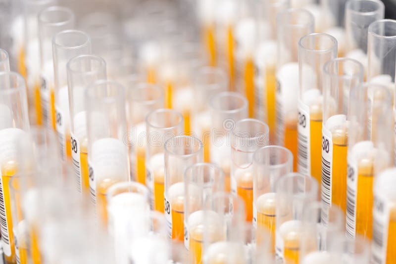 De reageerbuizen van het laboratoriumglas met oranje vloeistof voor een experiment in een laboratorium dat van het wetenschapsond stock foto's De reageerbuizen van het laboratoriumglas met oranje vloeistof voor een experiment in een laboratorium dat van het wetenschapsond stock foto's