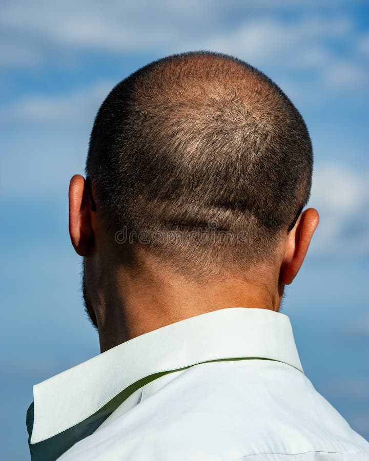 Coupe De Cheveux Homme Presque Chauve De Retour De L'homme Presque Chauve Photo stock - Image du mûr, adulte
