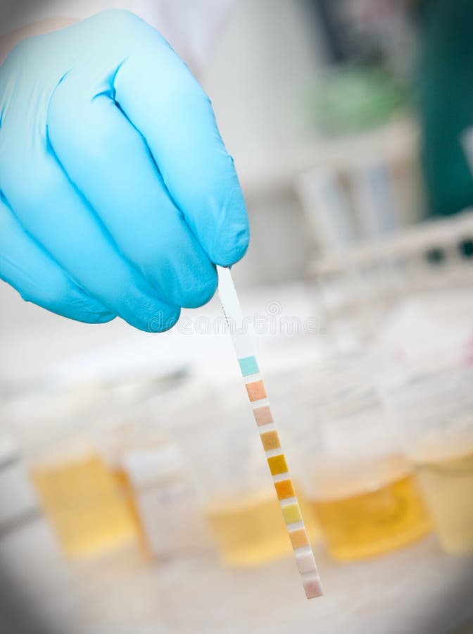 De test van de urine De test van de urine