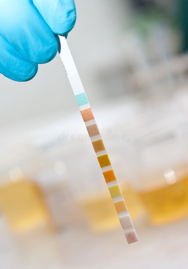De teststreep van het laboratorium De teststreep van het laboratorium