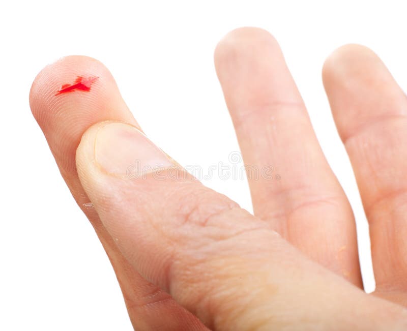 De vleeswonde van de vinger stock foto De vleeswonde van de vinger stock foto