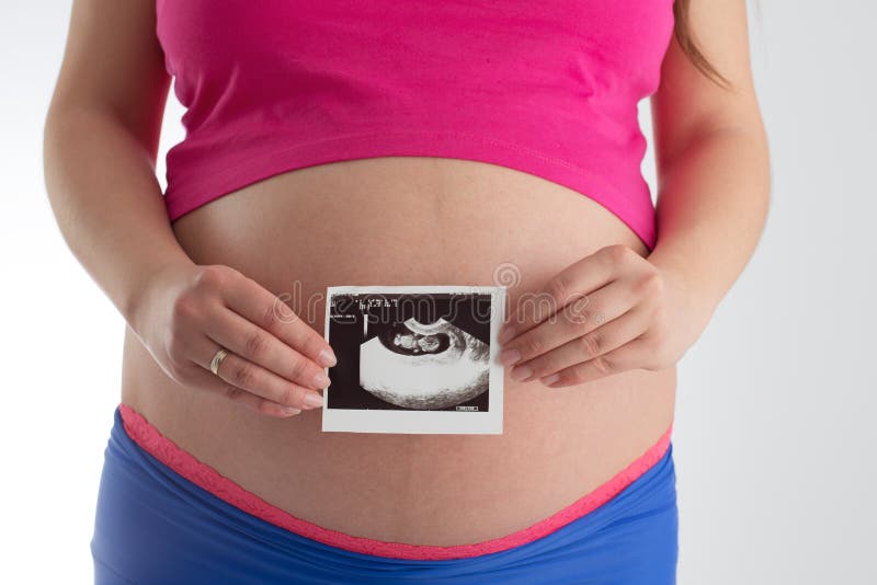 De zwangere de echoscopiefoto van de vrouwenholding van haar baby isoleert royalty-vrije stock afbeeldingen De zwangere de echoscopiefoto van de vrouwenholding van haar baby isoleert royalty-vrije stock afbeeldingen