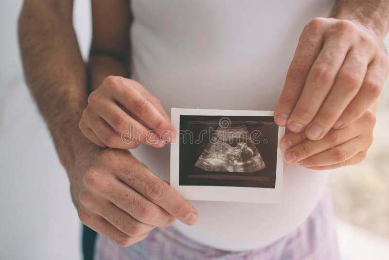 De zwangere echoscopie van de paarholding Concept Zwangerschapsgezondheidszorg royalty-vrije stock fotografie De zwangere echoscopie van de paarholding Concept Zwangerschapsgezondheidszorg royalty-vrije stock fotografie