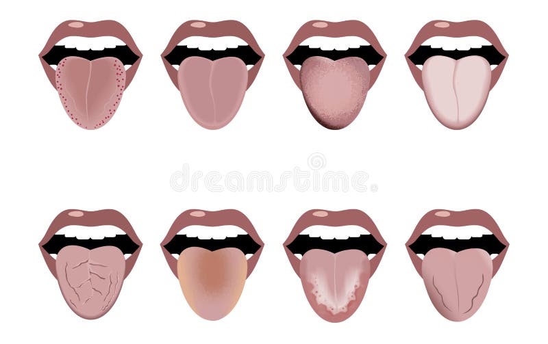 Open Mouth Sticking Out Tongue Stock Illustrations – 315 Open Mouth ...