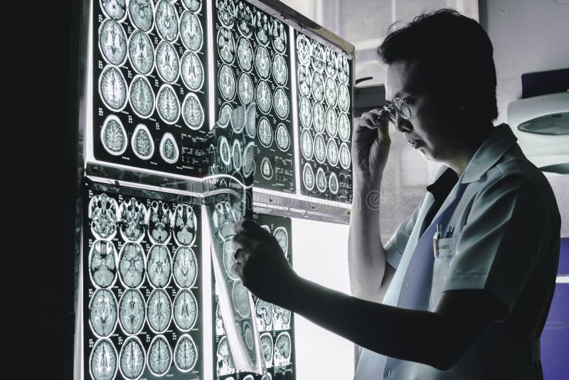 Demencja mózg na MRI