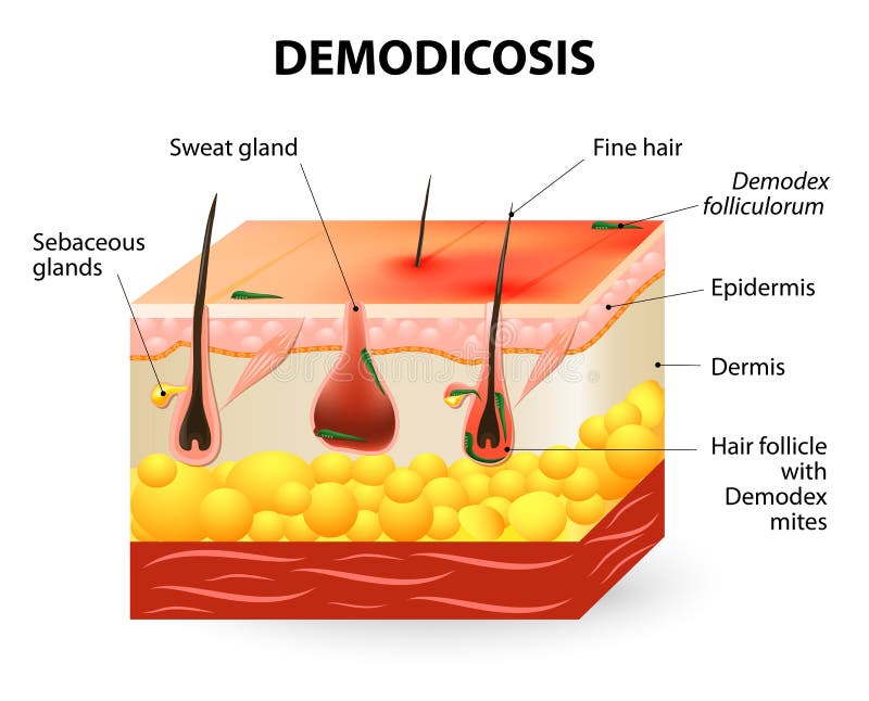 Demodicosis Ácaro de Demodex ilustração do vetor