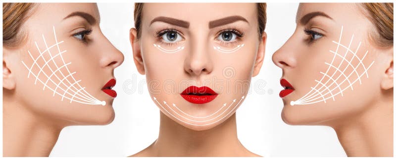 The young female face with clean fresh skin, antiaging and thread lifting concept. The young female face with clean fresh skin, antiaging and thread lifting concept