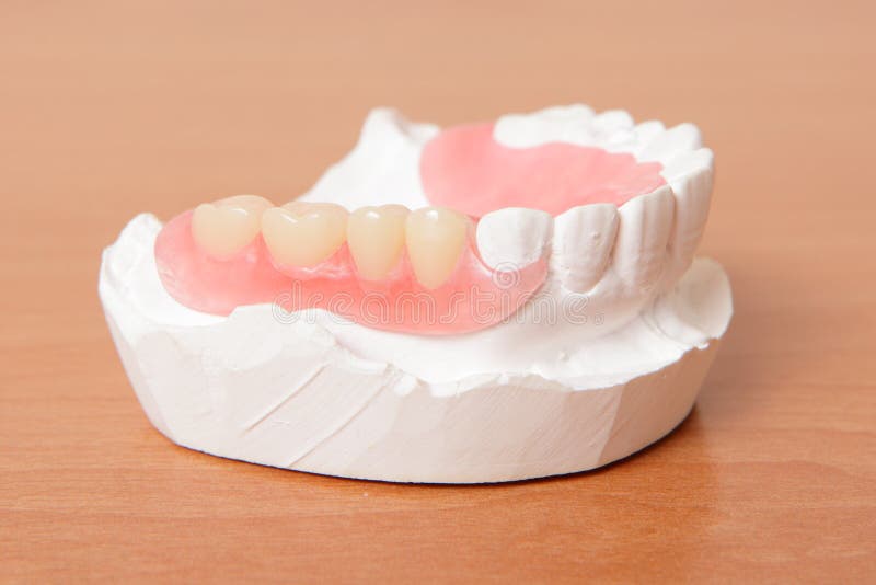 Dentadura de acrílico (dientes falsos)