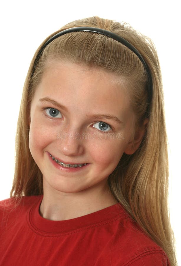 Dental Braces royalty free stock images