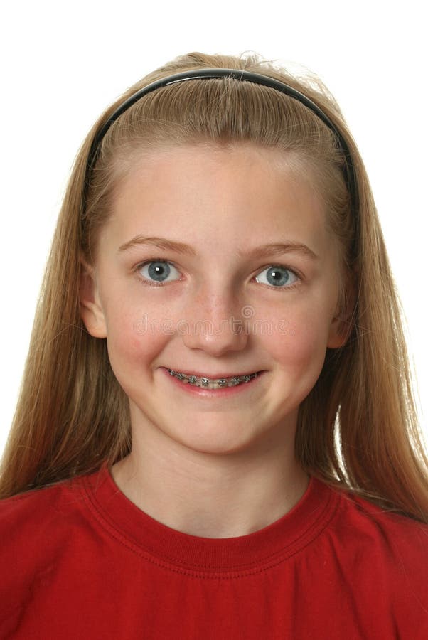 Dental Braces stock image. Image of cute, open, braces 13282845