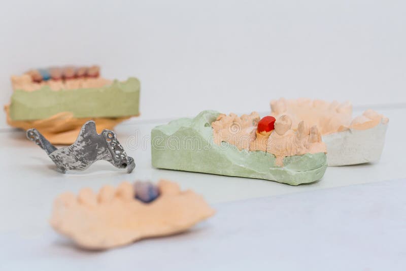 2,449 Dental Cast Model Stock Photos Free & RoyaltyFree Stock Photos