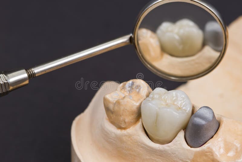 Dental ceramic crown stock image. Image of manufacturing 29102309