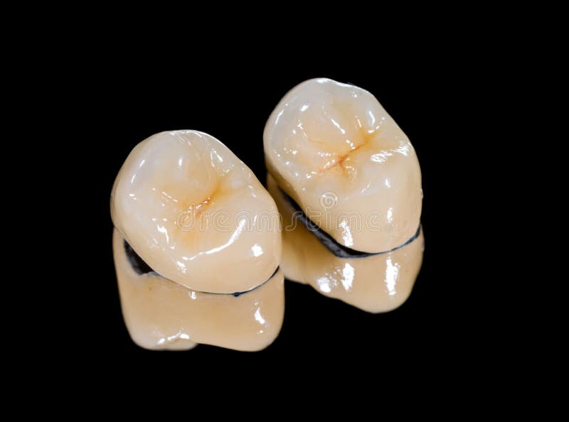 Dental ceramic crowns royalty free stock image Dental ceramic crowns royalty free stock image