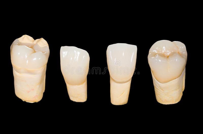 Dental ceramic crowns stock image. Image of care, conservative 44815241
