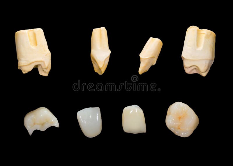 Ceramic crowns stock image. Image of human, production 34213545