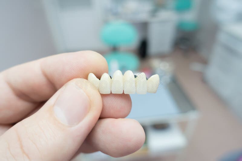 Dental Ceramic Metal Bridges in the Hands Stock Image Image of crown