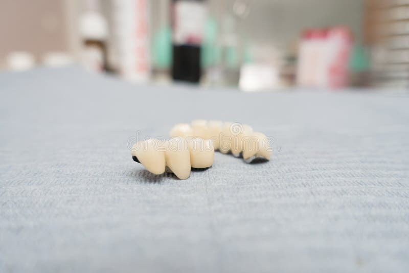 Dental Ceramic Metal Bridges Stock Image Image of ceramic, dentistry