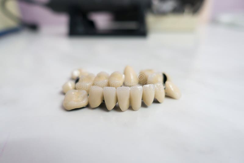 Dental Ceramic Metal Bridges Stock Image Image of ceramic, dentistry