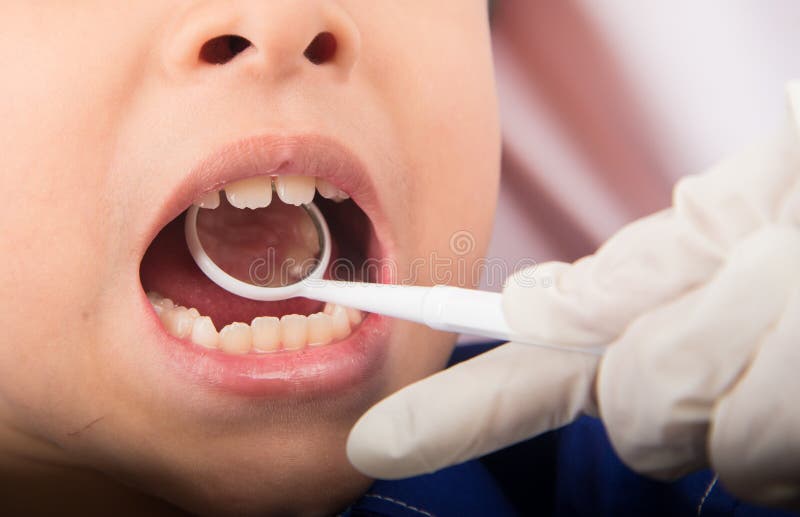 Dental check up on kids