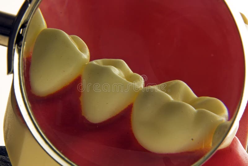 Dental exam stock image. Image of bone, gums, dentition 4079445