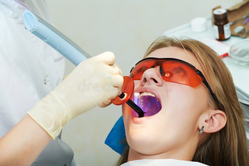 Dental Filing of Child Tooth by Ultraviolet Light Stock Image Image
