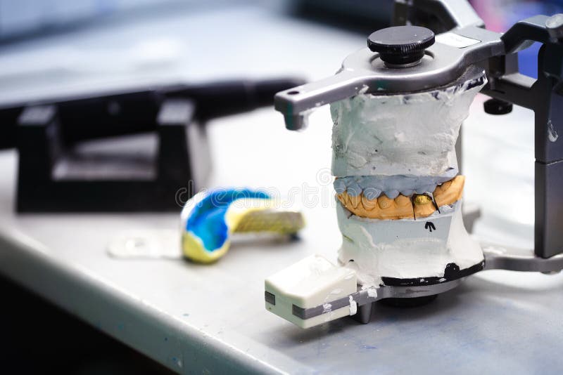 Dental Gypsum Model In Dentist Laboratory Office Closeup. Gypsum