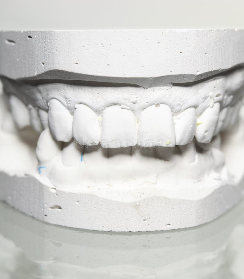 Dental Gypsum Model Mould Of Teeth In Plaster Royalty Free Dental Gypsum Model Mould Of Teeth In Plaster Royalty Free