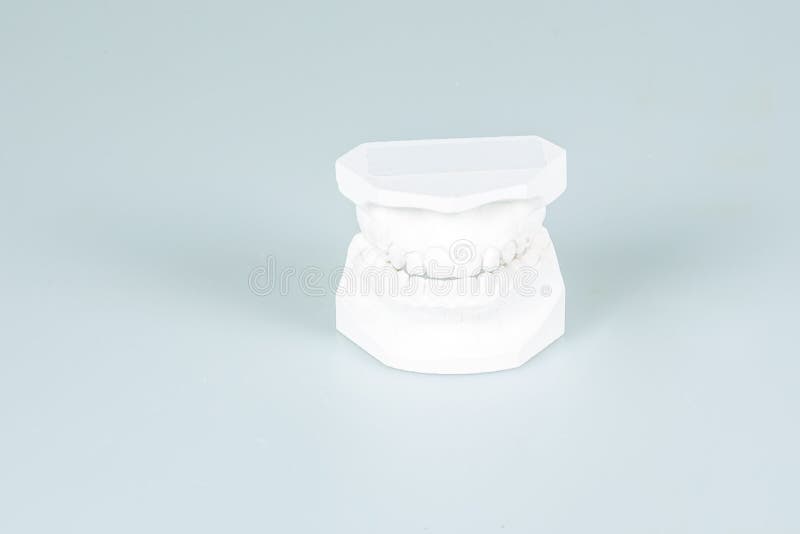 Dental Gypsum Model of Teeth Plaster Isolated on Background Stock Photo