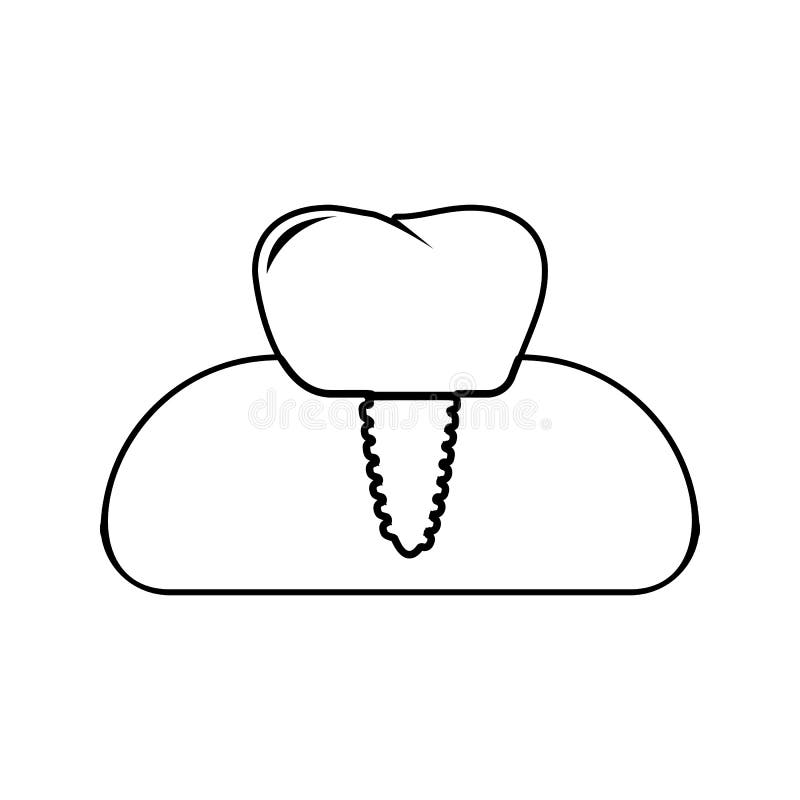 Dental implant icon. Element of cyber security for mobile concept and web apps icon. Thin line icon for website design and stock illustration