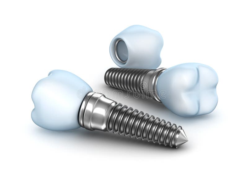 Dental Implants , Crown With Pin On White Stock Illustration Image