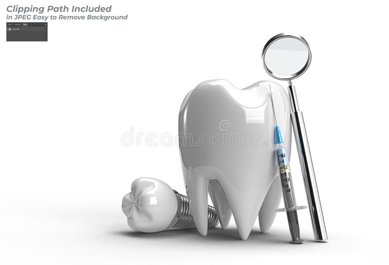 Dental Implants Surgery Concept Pen Tool Created Clipping Path Included in JPEG Easy to Composite