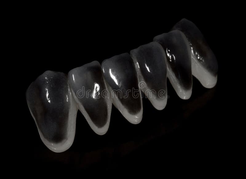 Dental Laboratory Work. Ceramic Teeth. Stock Image Image of