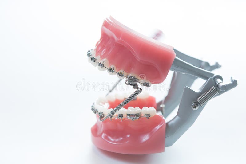 Dental Lower Jaw Bracket Braces Model on White Stock Photo Image of