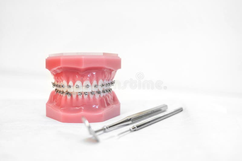 Dental Model with Braces Teeth Orthodontic Dental Model with Dental
