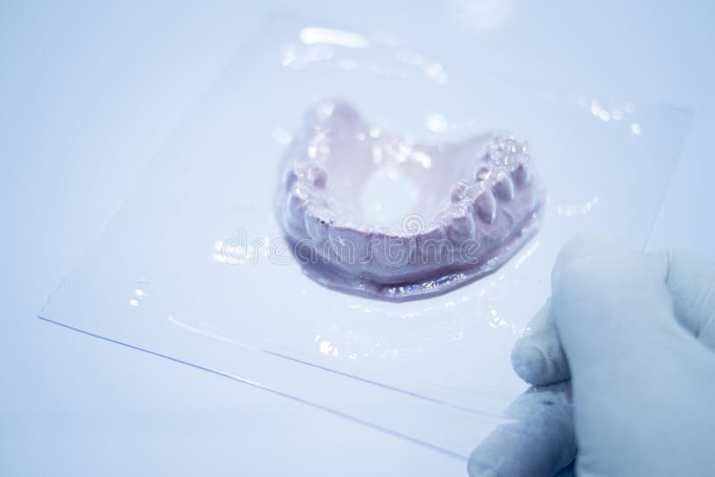 Dental Mold Dentist Clay Teeth Ceramic Plate Model Cast Stock Image - Image  of health, glove: 55520825