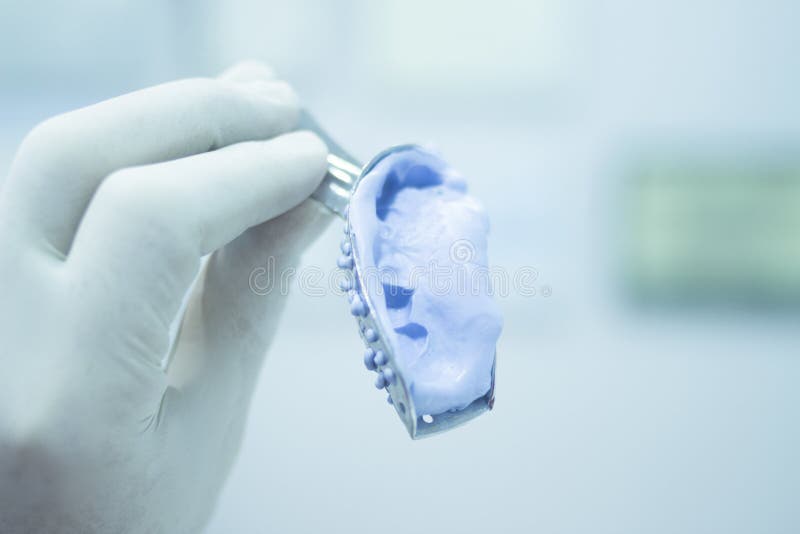 Dental Mold Dentist Clay Teeth Ceramic Plate Model Cast Stock Image - Image  of health, glove: 55520825