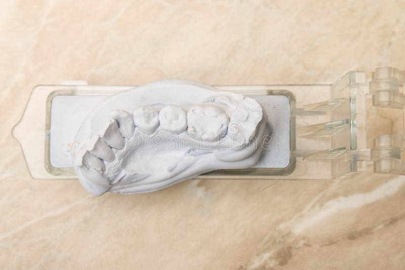 Dental Mold for Prosthetic Teeth Stock Image Image of cure, implants