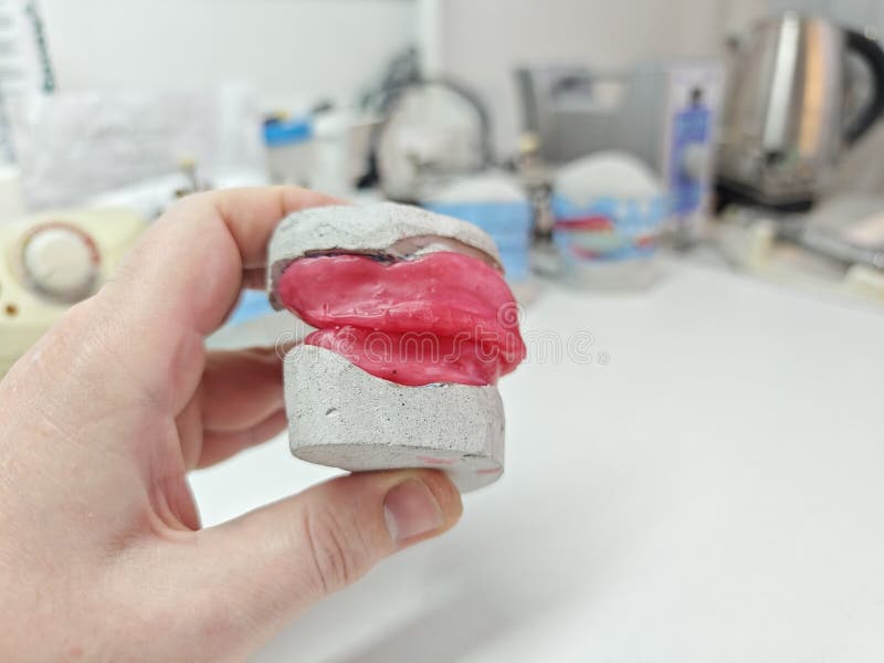 Dental Plaster Models with Denture Analogs in the Dental Laboratory Stock Image Image of