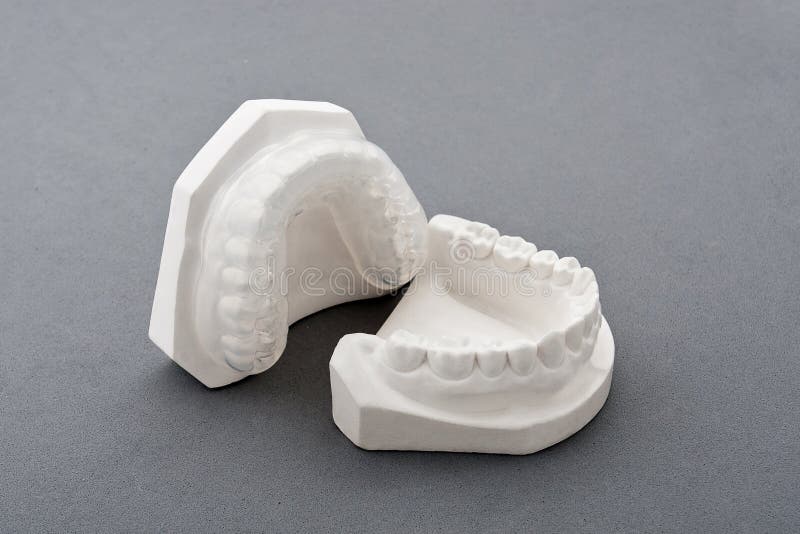 Dental plaster mold stock image. Image of lower, human 18758747